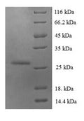 Recombinant Human Protein S100-A6 (S100A6) – Figure 1 of 1