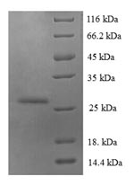 Recombinant Human Protein S100-A6 (S100A6) – Figure 1 of 1