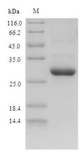 Recombinant Mouse Protein S100-A9 (S100a9) – Figure 1 of 1