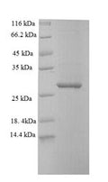 Recombinant Mouse SAM domain and HD domain-containing protein 1 (SAMHD1), partial – Figure 1 of 1