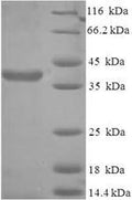 Recombinant Human Protein SCO2 homolog, mitochondrial (SCO2) – Figure 1 of 1