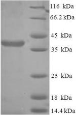 Recombinant Human Protein SCO2 homolog, mitochondrial (SCO2) – Figure 1 of 1