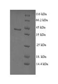 Recombinant Human Non-specific lipid-transfer protein (SCP2) – Figure 1 of 1