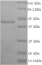 Recombinant Human Syndecan-1 (SDC1), partial – Figure 1 of 1