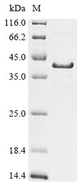 (Tris-Glycine gel) Discontinuous SDS-PAGE (reduced) with 5% enrichment gel and 15% separation gel.