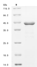 (Tris-Glycine gel) Discontinuous SDS-PAGE (reduced) with 5% enrichment gel and 15% separation gel.