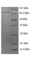 Recombinant Pig E-selectin (SELE), partial – Figure 1 of 1