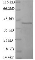 Recombinant Human Selenoprotein P (SELENOP) (U59S,U300S,U318S,U330S,U345S,U352S,U367S,U369S,U376S,U378S) – Figure 1 of 1