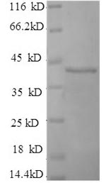 Recombinant Human Selenoprotein P (SELENOP) (U59S,U300S,U318S,U330S,U345S,U352S,U367S,U369S,U376S,U378S) – Figure 1 of 1