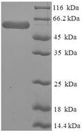 Recombinant Human Leukocyte elastase inhibitor (SERPINB1) – Figure 1 of 1