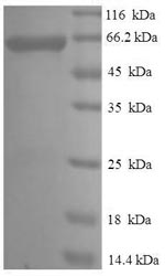 Recombinant Rat Plasminogen activator inhibitor 2 type A (Serpinb2) – Figure 1 of 1