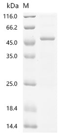 (Tris-Glycine gel) Discontinuous SDS-PAGE (reduced) with 5% enrichment gel and 15% separation gel.