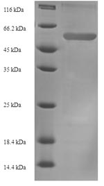 Recombinant Mouse Plasminogen activator inhibitor 1 (Serpine1) – Figure 1 of 1