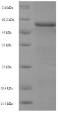 Recombinant Human Glia-derived nexin (SERPINE2) – Figure 1 of 1