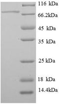Recombinant Rat pigment epithelium-derived factor (Serpinf1) – Figure 1 of 1