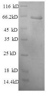 Recombinant Mouse Plasma protease C1 inhibitor (Serping1), partial – Figure 1 of 1