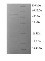 Recombinant Human 14-3-3 protein sigma (SFN) – Figure 1 of 1
