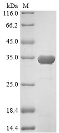(Tris-Glycine gel) Discontinuous SDS-PAGE (reduced) with 5% enrichment gel and 15% separation gel.