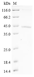 (Tris-Glycine gel) Discontinuous SDS-PAGE (reduced) with 5% enrichment gel and 15% separation gel.