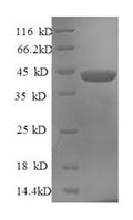 Recombinant Human Serine/arginine-rich splicing factor 1 (SRSF1) – Figure 1 of 1
