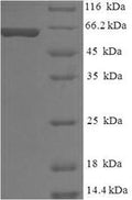 Recombinant Human Melanocyte protein PMEL (PMEL), partial – Figure 1 of 1