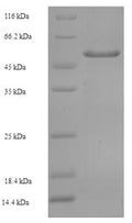 Recombinant Human Tyrosine-protein phosphatase non-receptor type substrate 1 (SIRPA), partial – Figure 1 of 1