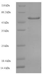 Recombinant Human Tyrosine-protein phosphatase non-receptor type substrate 1 (SIRPA), partial – Figure 1 of 1
