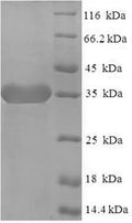 Recombinant Human Signal-regulatory protein delta (SIRPD) – Figure 1 of 1
