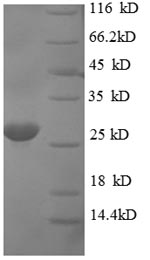 Recombinant Human Apoptosis regulatory protein Siva (SIVA1) – Figure 1 of 1