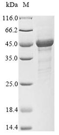 Recombinant Human S-phase kinase-associated protein 1 (SKP1) – Figure 1 of 1