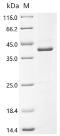 (Tris-Glycine gel) Discontinuous SDS-PAGE (reduced) with 5% enrichment gel and 15% separation gel.