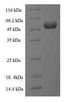 Recombinant Human Long-chain fatty acid transport protein 2 (SLC27A2), partial – Figure 1 of 1