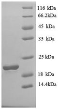 Recombinant Human Solute carrier family 41 member 2 (SLC41A2), partial – Figure 1 of 1