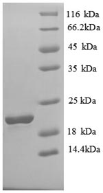 Recombinant Human Solute carrier family 41 member 2 (SLC41A2), partial – Figure 1 of 1