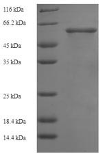 Recombinant Human Mothers against decapentaplegic homolog 3 (SMAD3) – Figure 1 of 1