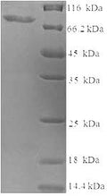 Recombinant Human Probable global transcription activator SNF2L2 (SMARCA2), partial – Figure 1 of 1