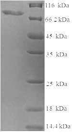 Recombinant Human Probable global transcription activator SNF2L2 (SMARCA2), partial – Figure 1 of 1