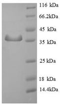 Recombinant Human Sperm mitochondrial-associated cysteine-rich protein (SMCP) – Figure 1 of 1