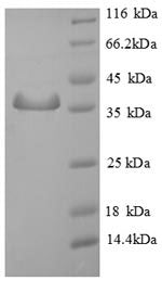 Recombinant Human Sperm mitochondrial-associated cysteine-rich protein (SMCP) – Figure 1 of 1