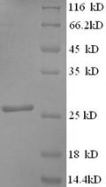 Recombinant Human Synaptosomal-associated protein 25 (SNAP25) – Figure 1 of 1