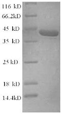 (Tris-Glycine gel) Discontinuous SDS-PAGE (reduced) with 5% enrichment gel and 15% separation gel.