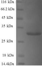 Recombinant Human Gamma-synuclein (SNCG) – Figure 1 of 1