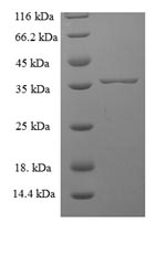 Recombinant Human Sorting nexin-24 (SNX24) – Figure 1 of 1