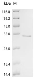 (Tris-Glycine gel) Discontinuous SDS-PAGE (reduced) with 5% enrichment gel and 15% separation gel.