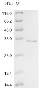 (Tris-Glycine gel) Discontinuous SDS-PAGE (reduced) with 5% enrichment gel and 15% separation gel.