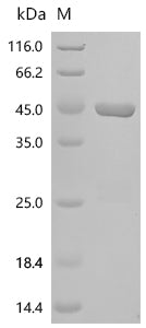 (Tris-Glycine gel) Discontinuous SDS-PAGE (reduced) with 5% enrichment gel and 15% separation gel.
