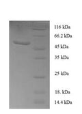 Recombinant Human Sclerostin domain-containing protein 1 (SOSTDC1) – Figure 1 of 1