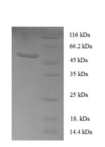 Recombinant Human Sclerostin domain-containing protein 1 (SOSTDC1) – Figure 1 of 1