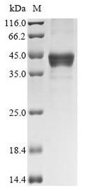 (Tris-Glycine gel) Discontinuous SDS-PAGE (reduced) with 5% enrichment gel and 15% separation gel.