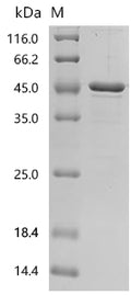(Tris-Glycine gel) Discontinuous SDS-PAGE (reduced) with 5% enrichment gel and 15% separation gel.